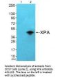 Anti-XPA Antibody