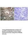 Anti-XPA Antibody