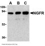 Anti-NGFR Antibody
