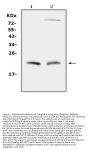 Anti-Cytoglobin/CYGB Antibody Picoband®