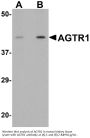 Anti-Type-1 angiotensin II receptor AGTR1 Antibody