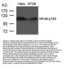 Anti-NFkB-p100 (Ab-866) NFKB2 Antibody