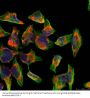 Anti-NFkB-p100 (Ab-866) NFKB2 Antibody