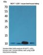 Anti-ACBP DBI Antibody