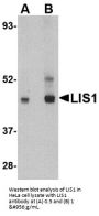 Anti-LIS1 PAFAH1B1 Antibody