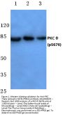 Anti-PKC Theta (phospho-S676) PRKCQ Antibody