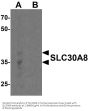 Anti-Zinc transporter 8 SLC30A8 Antibody