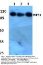 Anti-Wolframin WFS1 Antibody