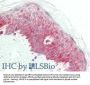 Anti-NCOA3/Src3 Antibody