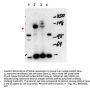 Anti-NCOA3/Src3 Antibody