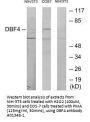 Anti-Protein DBF4 homolog A DBF4 Antibody