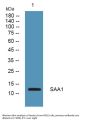 Anti-Serum amyloid A-1 protein SAA1 Antibody