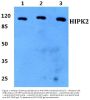 Anti-HIPK2 Antibody