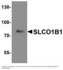 Anti-SLCO1B1 Antibody