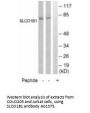 Anti-SLCO1B1/Oatp2 Antibody