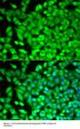 Anti-Fructose-1,6-bisphosphatase 1 FBP1 Antibody