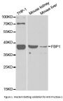 Anti-Fructose-1,6-bisphosphatase 1 FBP1 Antibody