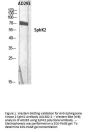 Anti-Sphingosine kinase 2 SphK2 Antibody