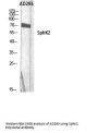 Anti-Sphingosine kinase 2 SphK2 Antibody