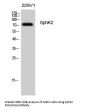 Anti-Sphingosine kinase 2 SphK2 Antibody