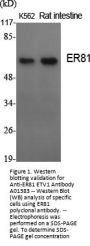 Anti-ER81 ETV1 Antibody