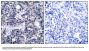Anti-PKR(Ab-446) EIF2AK2 Antibody