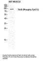 Anti-Phospho-Trk B (Y516) NTRK2 Antibody