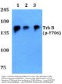 Anti-Trk B (phospho-Y706) NTRK2 Antibody