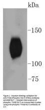 Anti-TrkB (Phospho-Y817) NTRK2 Antibody