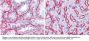 Anti-Collagen Type IV COL4A1 Antibody