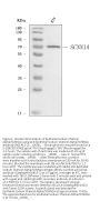 Anti-epithelial Sodium Channel alpha/SCNN1A Antibody Picoband®