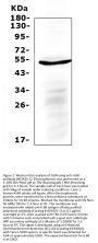 Anti-IL6R Antibody Picoband®