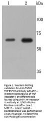 Anti-TNFR2 TNFRSF1B Antibody
