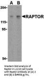 Anti-Raptor Rptor Antibody