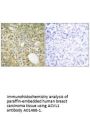 Anti-ACVL1 ACVRL1 Antibody