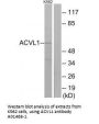 Anti-ACVL1 ACVRL1 Antibody