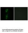 Anti-ACVL1 ACVRL1 Antibody