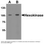 Anti-Hexokinase 1 HK1 Antibody