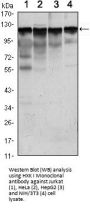 Anti-HXK I HK1 Monoclonal Antibody