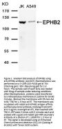 Anti-Ephrin type-B receptor 2 EPHB2 Antibody