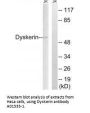 Anti-Dyskerin DKC1 Antibody
