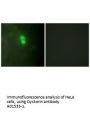 Anti-Dyskerin DKC1 Antibody
