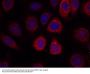 Anti-S6 Ribosomal Protein(Ab-235) RPS6 Antibody