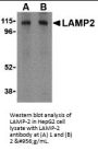 Anti-LAMP-2 Antibody