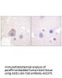 Anti-ADD1 (Ab-726) Antibody