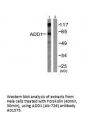 Anti-ADD1 (Ab-726) Antibody