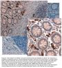 Anti-Nag-1 GDF15 Antibody Peroxidase Conjugated