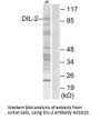 Anti-DIL-2 TPX2 Antibody