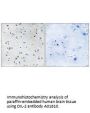 Anti-DIL-2 TPX2 Antibody