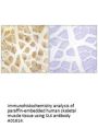 Anti-SLK Antibody